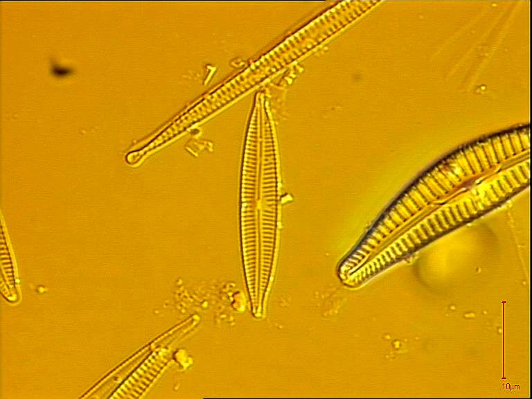 Encyonopsis cesatii, (Rabenhorst) Krammer, 1997 | Sandre 